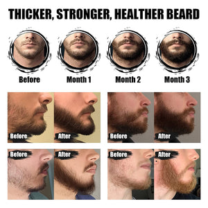Beard Growth Oil 2 Pack, Beard Growth Kit with Castor Oil Serum Conditioner for Men Beard Growth Stimulate Patchy Beard, Beard & Mustache Facial Hair Growth, Promote a Fuller, Thicker, Stronger Beard